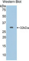 Western Blot; Sample: Recombinant protein.