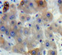 Used in DAB staining on fromalin fixed paraffin-embedded Liver tissue