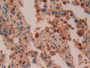 DAB staining on IHC-P; Samples: Human Lung Tissue; Primary Ab: 10µg/ml Rabbit Anti-Human AZU1 Antibody Second Ab: 2µg/mL HRP-Linked Caprine Anti-Rabbit IgG Polyclonal Antibody