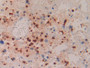 DAB staining on fromalin fixed paraffin- embedded liver tissue)
