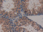 DAB staining on IHC-P; Samples: Mouse Testis Tissue; Primary Ab: 10µg/ml Rabbit Anti-Mouse MAPKAPK2 Antibody Second Ab: 2µg/mL HRP-Linked Caprine Anti-Rabbit IgG Polyclonal Antibody