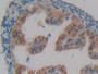 DAB staining on fromalin fixed paraffin- embedded testis tissue)