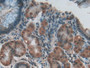 DAB staining on IHC-P; Samples: Human Stomach Tissue; Primary Ab: 20µg/ml Rabbit Anti-Human RXFP1 Antibody Second Ab: 2µg/mL HRP-Linked Caprine Anti-Rabbit IgG Polyclonal Antibody