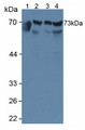 Western Blot; Sample: Lane1: Human Serum; Lane2: Human Hela Cells; Lane3: Human A549 Cells; Lane4: Human HepG2 Cells.