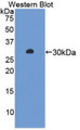 Western Blot; Sample: Recombinant protein.