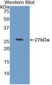 Western Blot; Sample: Recombinant protein.