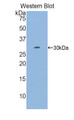 Western Blot; Sample: Recombinant protein.