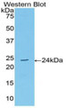 Western Blot; Sample: Recombinant AchE, Human.