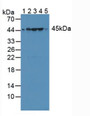 Western Blot; Sample: Lane1: Rat Serum; Lane2: Rat Liver Tissue; Lane3: Rat Heart Tissue; Lane4: Rat Brain Tissue; Lane5: Human Jurkat Tissue.