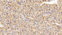 DAB staining on IHC-P; Samples: Rat Adrenal gland Tissue; Primary Ab: 20µg/ml Rabbit Anti-Rat TH Antibody Second Ab: 2µg/mL HRP-Linked Caprine Anti-Rabbit IgG Polyclonal Antibody