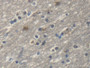 DAB staining on IHC-P; Samples: Human Cerebrum Tissue; Primary Ab: 20µg/ml Rabbit Anti-Human TH Antibody Second Ab: 2µg/mL HRP-Linked Caprine Anti-Rabbit IgG Polyclonal Antibody