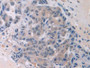 DAB staining on fromalin fixed paraffin-embedded Stomach tissue)