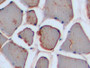 DAB staining on IHC-P; Samples: Rat Skeletal muscle Tissue; Primary Ab: 10µg/ml Rabbit Anti-Rat MSE Antibody Second Ab: 2µg/mL HRP-Linked Caprine Anti-Rabbit IgG Polyclonal Antibody