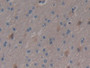 DAB staining on IHC-P; Samples: Human Brain Tissue.