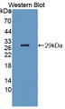 Western Blot; Sample: Recombinant protein.