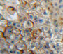 DAB staining on fromalin fixed paraffin-embedded liver tissue)