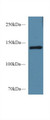 Western Blot; Sample: Mouse Serum; Primary Ab: 1µg/ml Rabbit Anti-Mouse SEMA4D Antibody Second Ab: 0.2µg/mL HRP-Linked Caprine Anti-Rabbit IgG Polyclonal Antibody