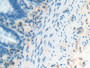 DAB staining on IHC-P; Samples: Human Rectum Tissue; Primary Ab: 20µg/ml Rabbit Anti-Human IFNa/bR1 Antibody Second Ab: 2µg/mL HRP-Linked Caprine Anti-Rabbit IgG Polyclonal Antibody