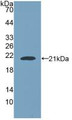 Western Blot; Sample: Recombinant NUP210, Human.