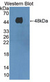 Western Blot; Sample: Recombinant protein.