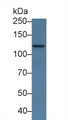 Western Blot; Sample: Human MCF7 cell lysate; Primary Ab: 3µg/ml Rabbit Anti-Mouse ADCY7 Antibody Second Ab: 0.2µg/mL HRP-Linked Caprine Anti-Rabbit IgG Polyclonal Antibody