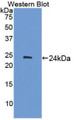 Western Blot; Sample: Recombinant protein.