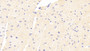 DAB staining on fromalin fixed paraffin- embedded Kidney tissue)