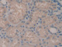 DAB staining on IHC-P; Samples: Human Kidney Tissue; Primary Ab: 20µg/ml Rabbit Anti-Human ADCY7 Antibody Second Ab: 2µg/mL HRP-Linked Caprine Anti-Rabbit IgG Polyclonal Antibody