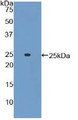 Western Blot; Sample: Recombinant ADCY6, Mouse.