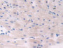 DAB staining on IHC-P; Samples: Mouse Heart Tissue; Primary Ab: 10µg/ml Rabbit Anti-Mouse ADCY6 Antibody Second Ab: 2µg/mL HRP-Linked Caprine Anti-Rabbit IgG Polyclonal Antibody