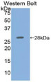 Western Blot; Sample: Recombinant protein.