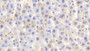 DAB staining on IHC-P; Samples: Rat Liver Tissue; Primary Ab: 20μg/ml Rabbit Anti-Rat HB Antibody Second Ab: 2µg/mL HRP-Linked Caprine Anti-Rabbit IgG Polyclonal Antibody