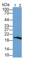 Hemoglobin (HB) Polyclonal Antibody, CAU25985