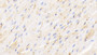 DAB staining on IHC-P; Samples: Canine Cardiac Muscle Tissue; Primary Ab: 20μg/ml Rabbit Anti-Canine HB Antibody Second Ab: 2µg/mL HRP-Linked Caprine Anti-Rabbit IgG Polyclonal Antibody
