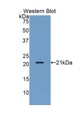 Western Blot; Sample: Recombinant KLRD1, Human.