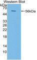 Western Blot; Sample: Recombinant protein.