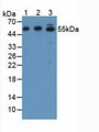 Western Blot; Sample: Lane1: Human SGC7901 Cells; Lane2: Human Hela Cells; Lane3: Rat Stomach Tissue