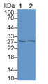 Western Blot; Sample: Lane1: Jurkat cell lysate; Lane2: Hela cell lysate; Primary Ab: 1μg/ml Rabbit Anti-Human PAFAH1B3 Antibody; Second Ab: 0.2µg/mL HRP-Linked Caprine Anti-Rabbit IgG Polyclonal Antibody;