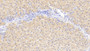 DAB staining on fromalin fixed paraffin-embedded Kidney tissue)