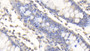 DAB staining on IHC-P; Samples: Human Colon Tissue;  Primary Ab: 20μg/ml Rabbit Anti-Human vWA2 Antibody Second Ab: 2µg/mL HRP-Linked Caprine Anti-Rabbit IgG Polyclonal Antibody 