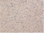 Figure. DAB staining on IHC-P; Samples: Rat Ovary Tissue.