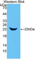 Western Blot; Sample: Recombinant NGAL, Mouse.