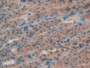 DAB staining on IHC-P; Samples: Rat Intestine Tissue; Primary Ab: 20µg/ml Rabbit Anti-Rat ATF4 Antibody Second Ab: 2µg/mL HRP-Linked Caprine Anti-Rabbit IgG Polyclonal Antibody