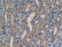 DAB staining on fromalin fixed paraffin- embedded stomach tissue)