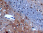 DAB staining on IHC-P; Samples: Mouse Cerebrum Tissue; Primary Ab: 10µg/ml Rabbit Anti-Mouse ANO1 Antibody Second Ab: 2µg/mL HRP-Linked Caprine Anti-Rabbit IgG Polyclonal Antibody