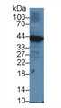 Western Blot; Sample: Human Raji cell lysate; Primary Ab: 1µg/ml Rabbit Anti-Human Iga Antibody Second Ab: 0.2µg/mL HRP-Linked Caprine Anti-Rabbit IgG Polyclonal Antibody