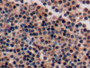 DAB staining on fromalin fixed paraffin-embedded Stomach tissue)