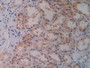 DAB staining on IHC-P; Samples: Human Kidney Tissue.