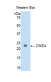 Western Blot; Sample: Recombinant protein.