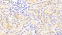 DAB staining on IHC-P; Samples: Human Kidney Tissue;  Primary Ab: 20μg/ml Rabbit Anti-Human DEFb1 Antibody Second Ab: 2µg/mL HRP-Linked Caprine Anti-Rabbit IgG Polyclonal Antibody 